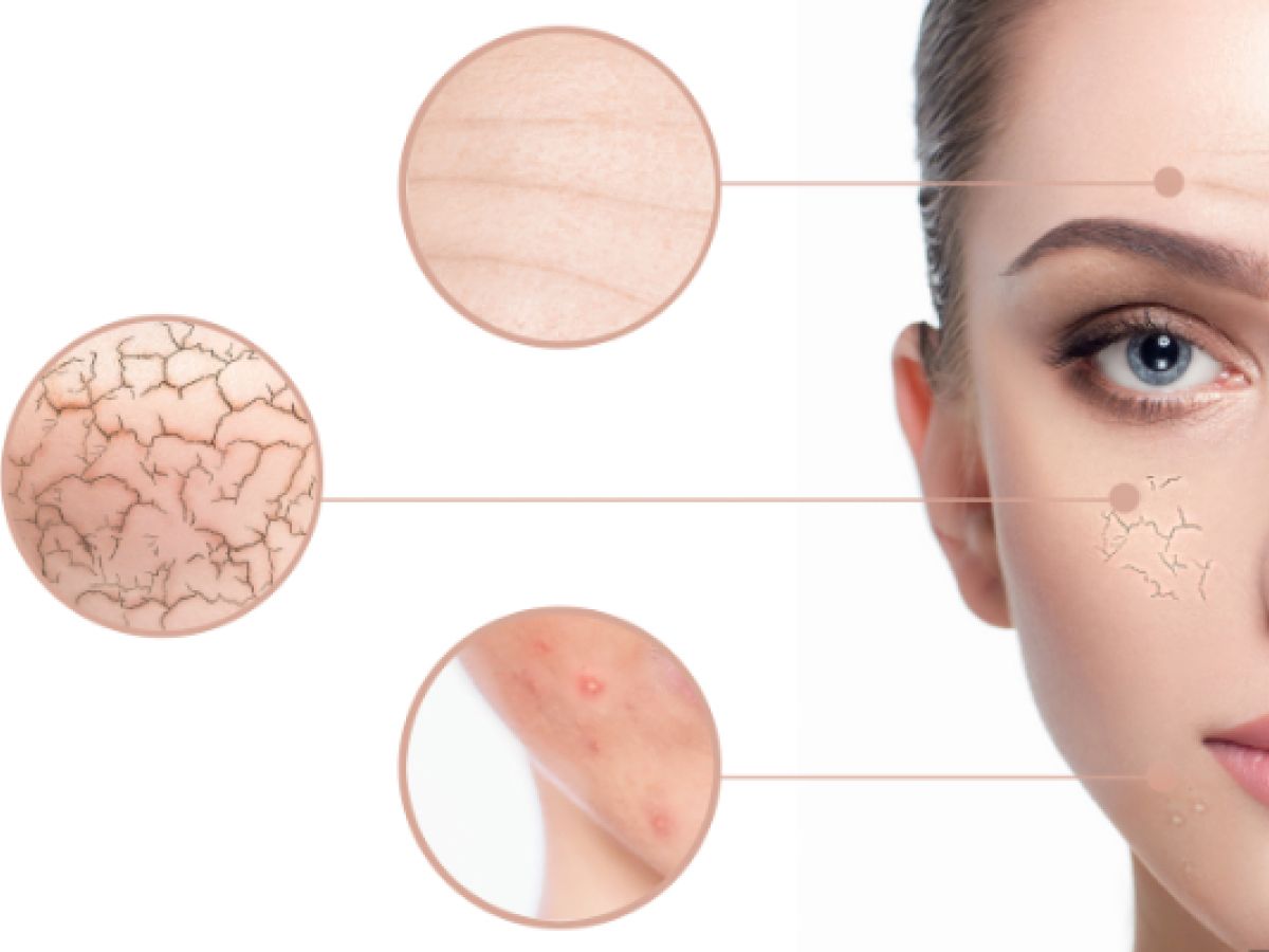 fruchtsaeure peeling