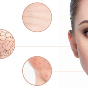 fruchtsaeure peeling
