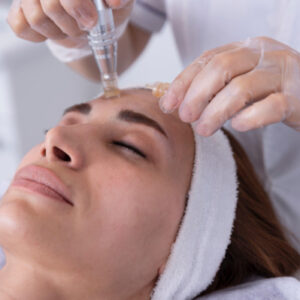 needling